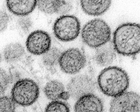 Hantavirus-Ausbruch auf Kreuzfahrt: Erkrankte Passagiere, Quarantäne und WHO-Risikoanalyse.