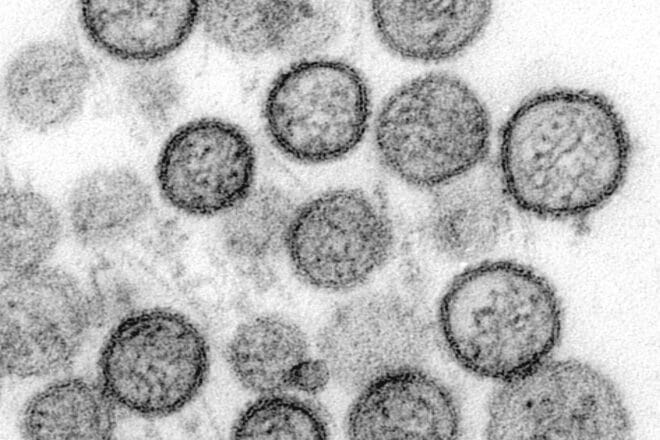 WHO: Hantavirus auf Schiff wurde von Mensch zu Mensch übertragen